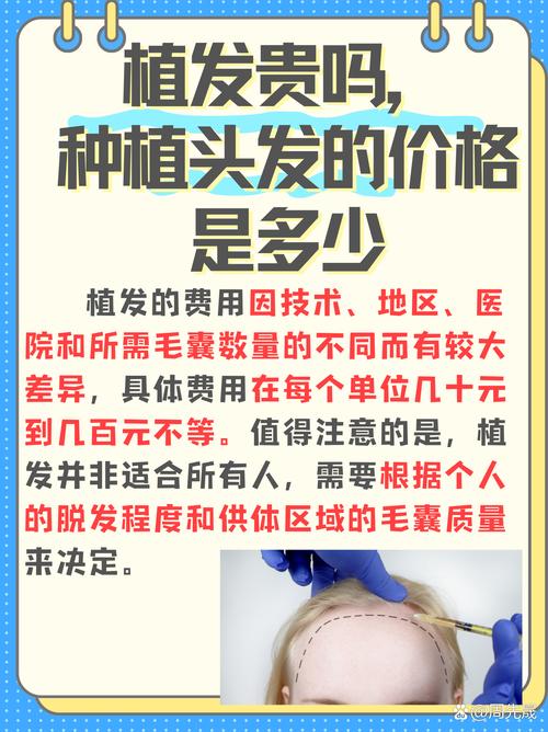 植发多少钱一根定，植发每根多少钱？